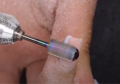 What is a Nail Fill