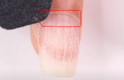 What is a Nail Fill