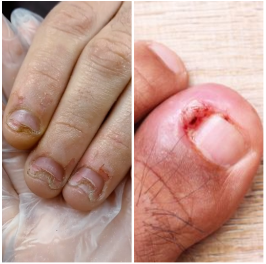 ugly nails