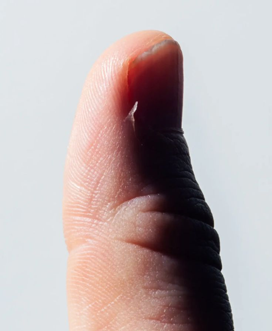ugly nails